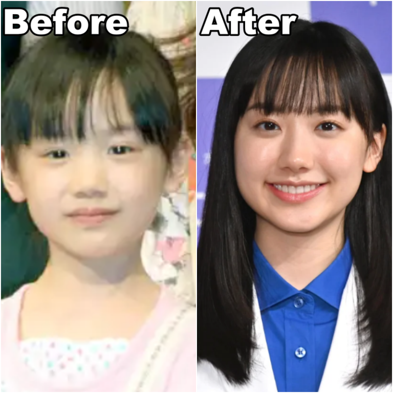 芦田愛菜整形の当時の様子・関連報道写真